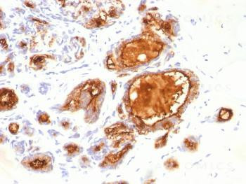 Anti-MUC1 / CA15-3 / EMA / CD227 (Epithelial Marker) Monoclonal Antibody (Clone: 115D8)