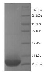 Beta-1 adrenergic receptor (ADRB1), partial, human, recombinant