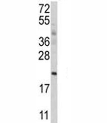 Anti-ATG12