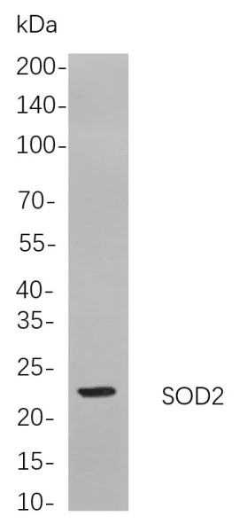 Anti-Recombinant SOD2, clone 6F2