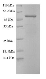 Disintegrin and metalloproteinase domain-containing protein 15 (ADAM15), partial, human, recombinant