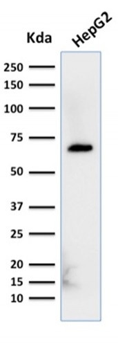Anti-Albumin (Transport Protein), clone ALB/2356