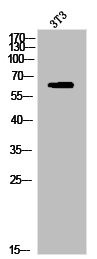 Anti-Phospho-PAK1 (S204)