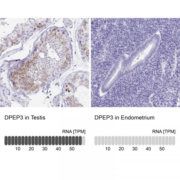 Anti-DPEP3