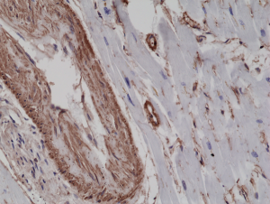 Anti-ACTA2, Rabbit Monoclonal (RM253)