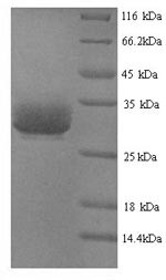 Thrombin-like enzyme ancrod, Calloselasma rhodostoma, recombinant