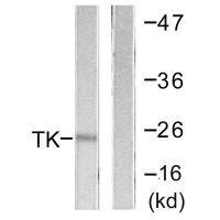 Anti-TK1 (Ab-13)