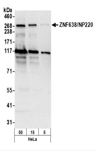 Anti-ZNF638/NP220