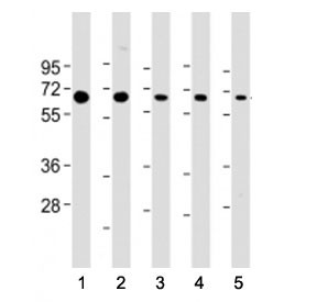 Anti-PSMD3 (C-Terminal Region)