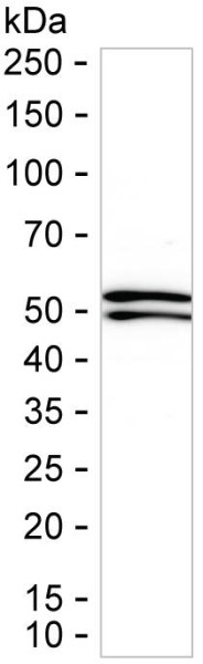 Anti-TGFBR1