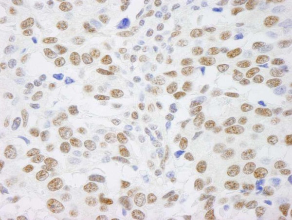 Anti-SAFB1 (IHC)