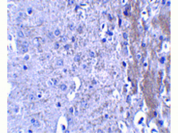 Anti-MATN4