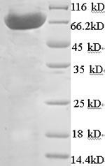 ATP synthase subunit beta, mitochondrial (Atp5b), mouse, recombinant