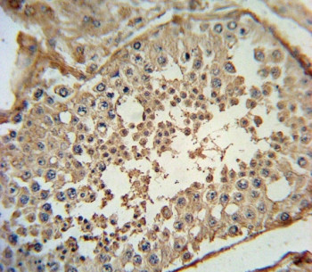Anti-ADCYAP1 / PACAP