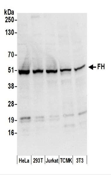 Anti-FH/Fumarate Hydratase