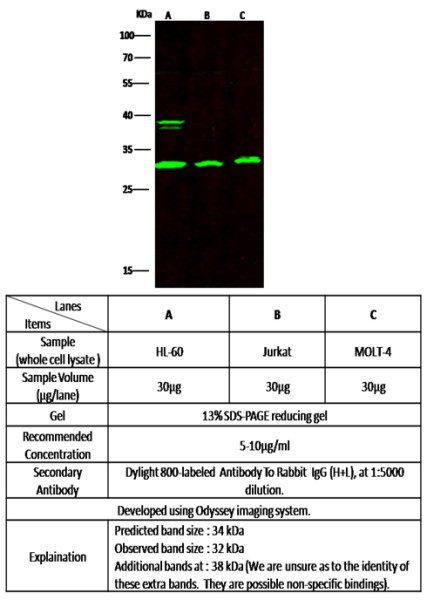 Anti-BLyS/TNFSF13B/BAFF Monoclonal Recombinant Antibody