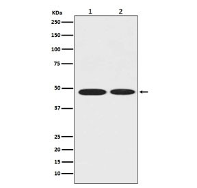 Anti-Alpha Enolase / ENO1, clone AEA-5