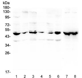 Anti-NSE / Neuron Specific Enolase