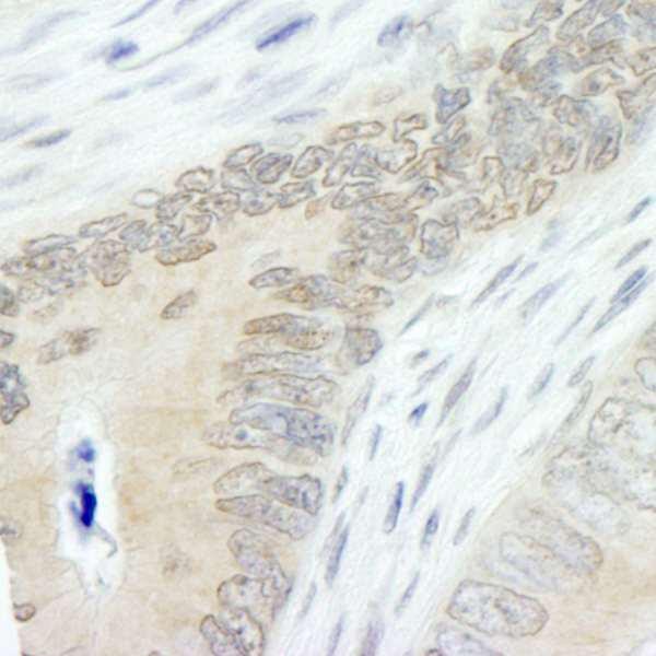 Anti-Lasu1/Ureb1 (IHC)