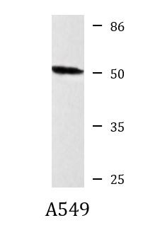 Anti-Aldehyde dehydrogenase 10, clone 3F7-H9-E12