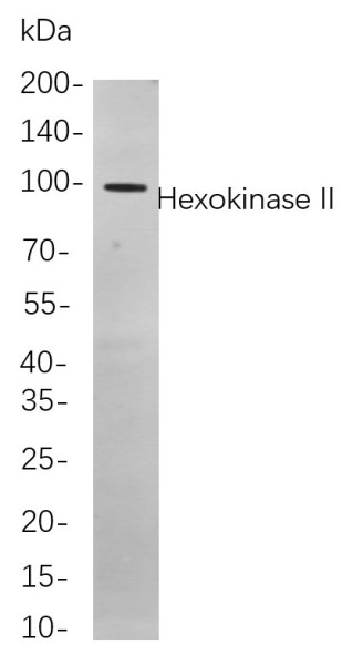 Anti-Recombinant Hexokinase II, clone 1F10