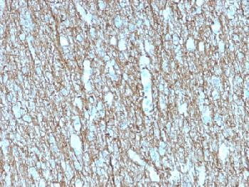 Anti-Neurofilament (NF-H) (Neuronal Marker) Recombinant Mouse Monoclonal Antibody (clone:rNF421)