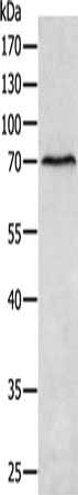 Anti-MATN4