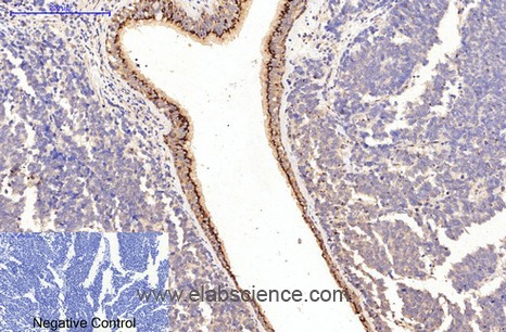 Anti-COL1A1, clone 3C3