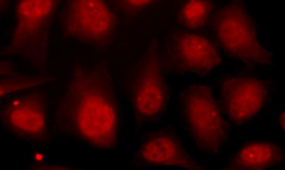 Anti-DNA polymerase beta