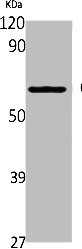 Anti-CYP2A6/CYP2A7/CYP2A13