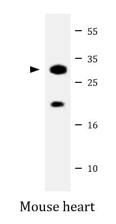 Anti-Aquaporin 11