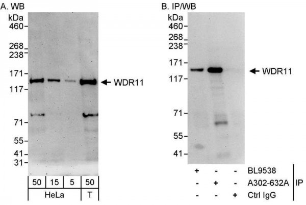 Anti-WDR11