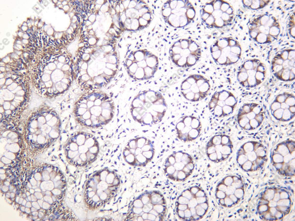 Anti-Recombinant Cortactin, clone C111768