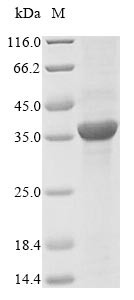 Penicillin-binding protein 1B (mrcB), partial, Escherichia coli, recombinant