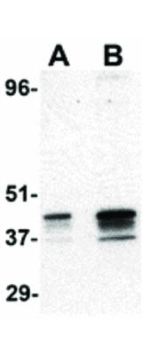 Anti-p53R2