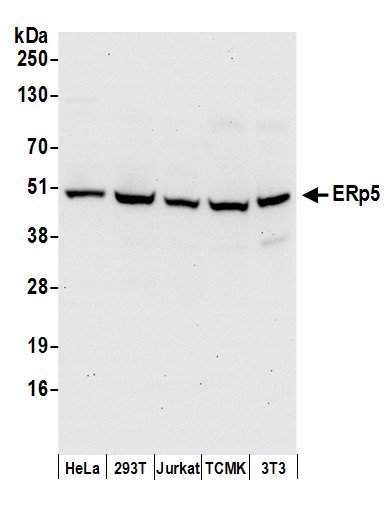 Anti-ERp5