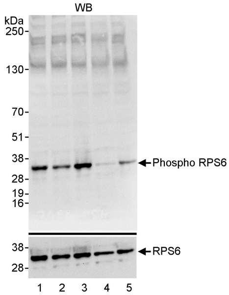 Anti-phospho-RPS6 (Ser235/236)