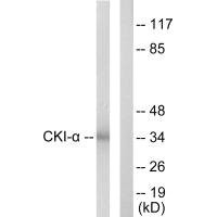 Anti-CSNK1A1