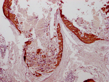 Anti-KRT7 Monoclonal