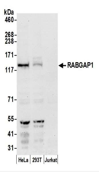 Anti-RABGAP1