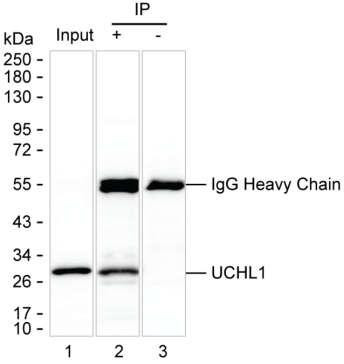 Anti-UCHL1