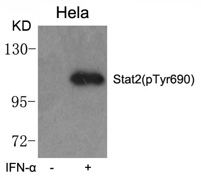 Anti-phospho-STAT2 (Tyr690)