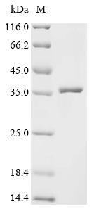 Polyhedrin (PH), recombinant Bombyx mori nuclear polyhedrosis virus