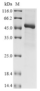 Kelch domain-containing protein 3 (KLHDC3), human, recombinant