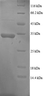 Growth arrest and DNA damage-inducible protein GADD45 alpha (GADD45A), human, recombinant