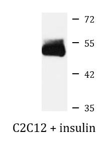 Anti-phospho-NDRG1 (Ser330)