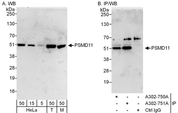 Anti-PSMD11