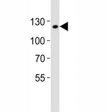 Anti-SIRT1