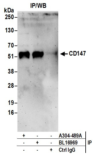 Anti-CD147