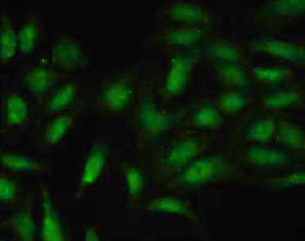 Anti-phospho-p38 MAPK (Tyr322)